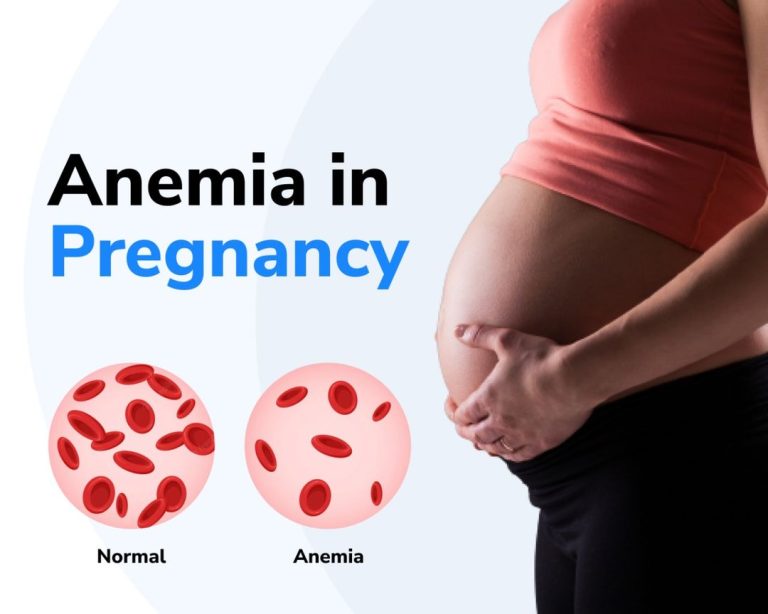 ANEMIA IN PREGNANCY